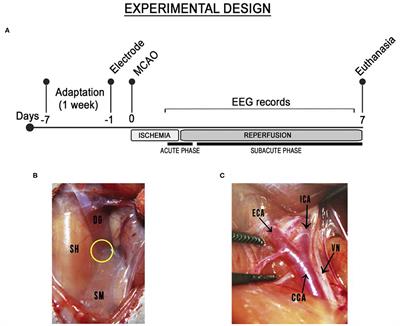 Increased Relative Delta Bandpower and Delta Indices Revealed by Continuous qEEG Monitoring in a Rat Model of Ischemia-Reperfusion